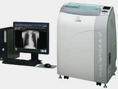 デジタルX線画像診断システムFCR